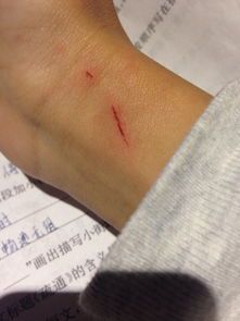 宠物抓伤出血,急救攻略速学!