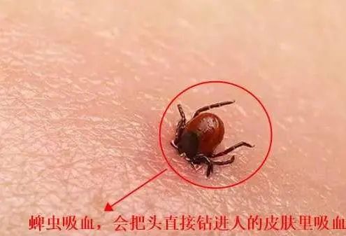 宠物身上发现蜱虫?速用宠物专用除虫剂!
