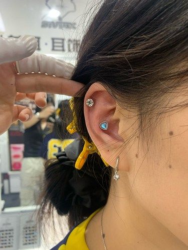 耳骨钉