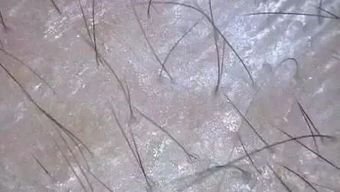 宠物阴茎头白包，病因何在？