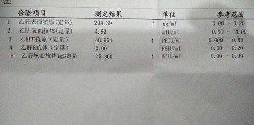 宠物转氨酶高,科学调理指南