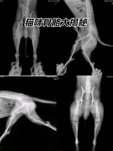 成长轨迹：髌骨脱位