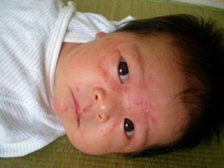 宠物湿疹传染吗？预防攻略！