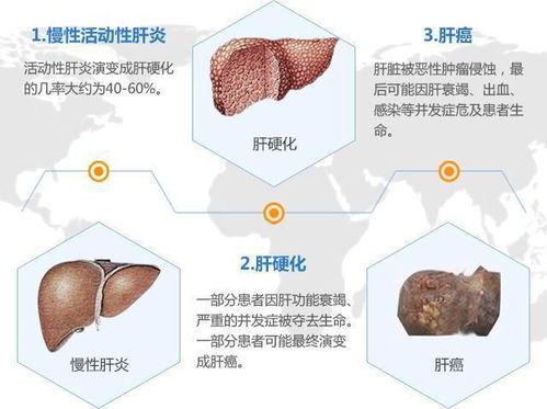 宠物肝肥大,科学治疗是关键。