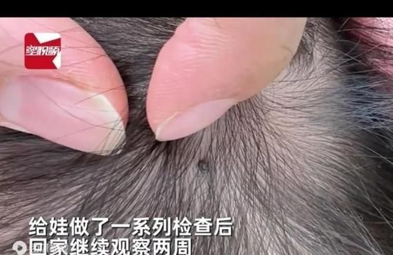 宠物猫身上的蜱虫危害与预防（如何保护你的爱猫不受蜱虫侵扰）