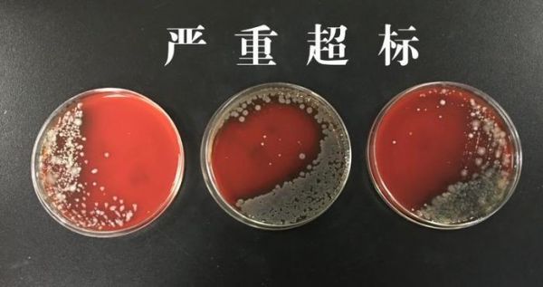 妈妈们注意了：宝宝洗澡时经常玩的小黄鸭，里面超级脏！