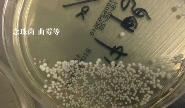 妈妈们注意了：宝宝洗澡时经常玩的小黄鸭，里面超级脏！