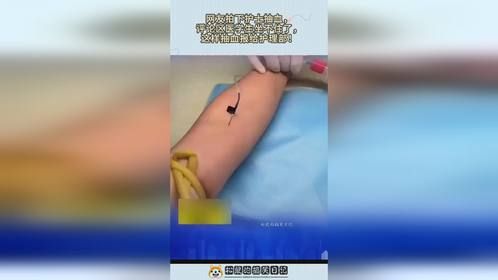 网友拍下护士抽血，评论区医学生坐不住了，这样抽血报给护理部！
