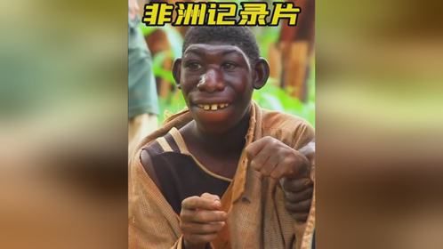 非洲长相奇特的男孩，因为外表爆红，如今过上了无忧无虑的生活