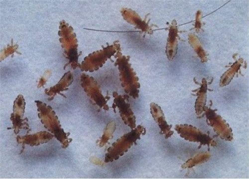 宠物虱子困扰?有妙招!