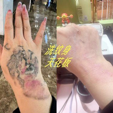 洗纹身天花板、二手纹身清洗