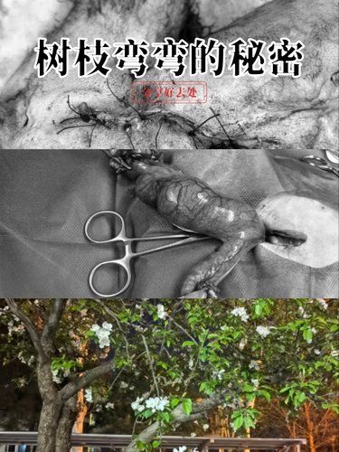 守护病患的日常
