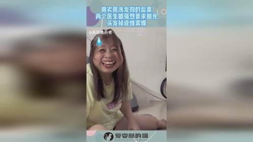 用劣质洗发剂的后果，两个医生都强烈要求剃光，头发掉成蜂窝煤！