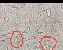 宠物猫感染滴虫的大便问题（如何有效防治猫咪感染滴虫）