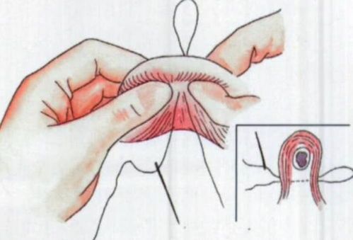 宠物结扎的重要性？如何正确选择宠物结扎医院