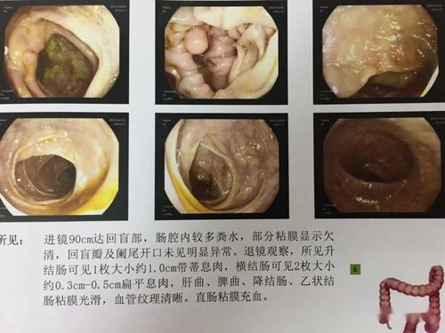 宠物结扎费用不一，注意术前禁食禁水，术后休息。
