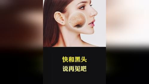 快和黑头说再见吧
