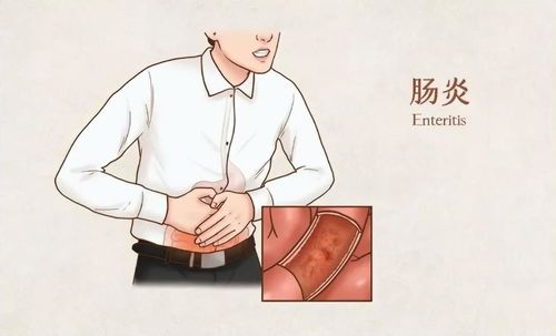 宠物肠胃炎,早发现早治疗!