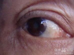 宠物白内障中药疗法详解