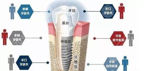局部麻醉药心脏副作用案例分析（局部麻醉心脏副作用预防策略局部麻醉心脏副作用急救措施）