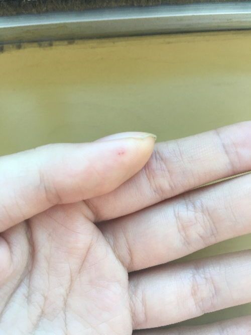 宠物伤口消炎消肿攻略