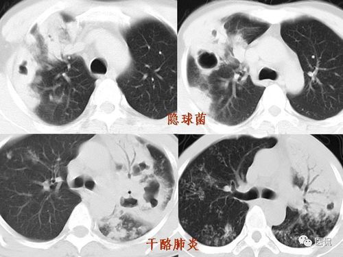 宠物黄缘腹甲真菌感染怎么办?