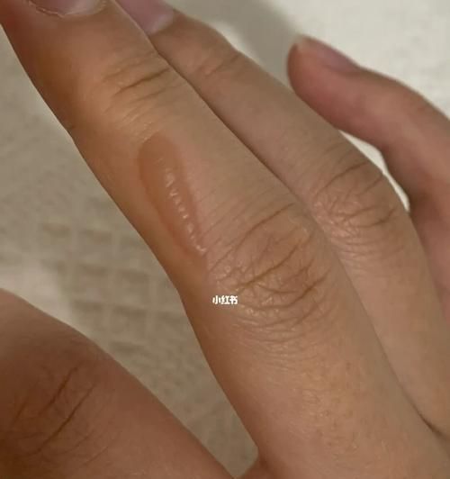 宠物烫伤和烧伤急救指南（如何快速有效地处理宠物的烫伤和烧伤？）