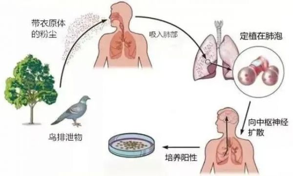母女俩双双确诊，严重可致死！竟和家中宠物有关