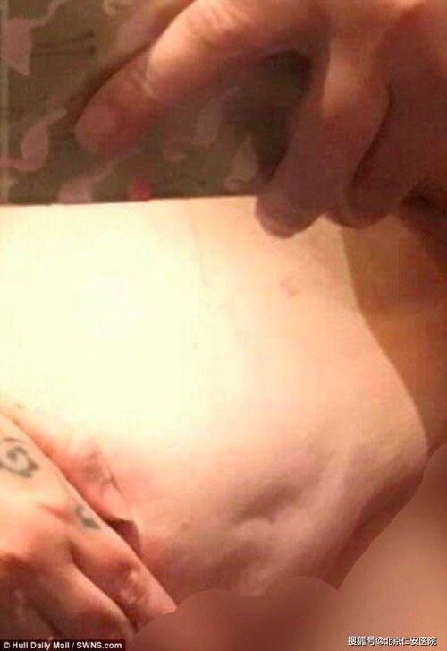 宠物食欲不振，警惕消化系统疾病。