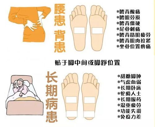 宠物打吊针找血管技巧及常见问题解答