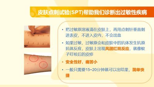 挑选低敏猫粮,远离过敏困扰。