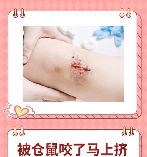 宠物鼠咬人事件的排名情况如何？