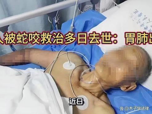 四川被蛇咬伤老人去世:胃肺出血 多重失误叠加悲剧