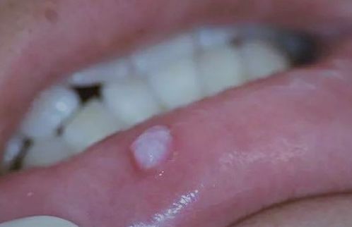 宠物口腔粘液异常，警惕健康隐患。