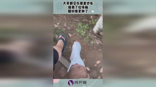 大哥脚受伤缠着纱布，撞到了垃圾桶，腿好像更肿了！