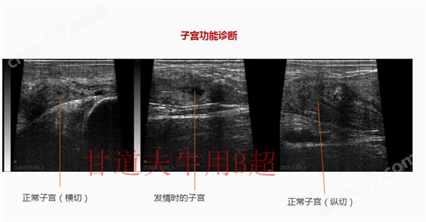子宫不同时期超声影像.png