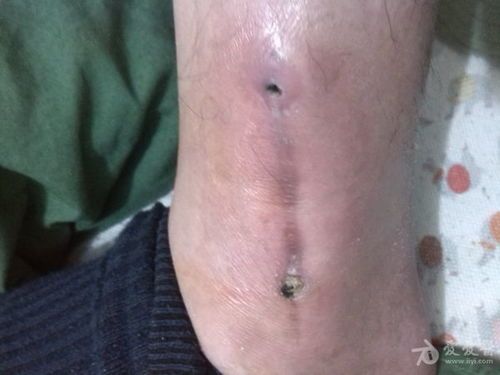 宠物手术后伤口怎么愈合（正确的伤口护理方法）