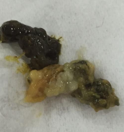 狗狗大便里的虫是什么样的？如何识别和处理？