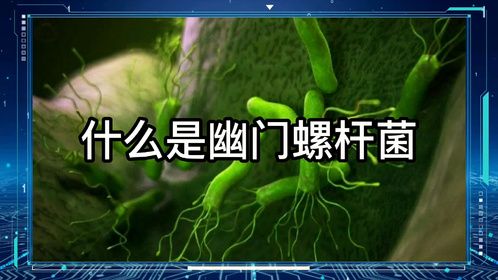 什么是幽门螺杆菌