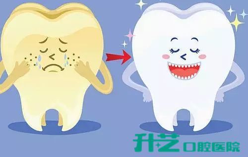 宠物口腔健康，预防牙结石困扰