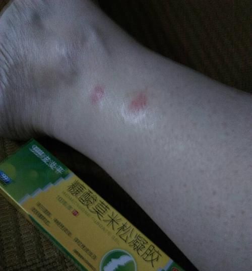如何避免狗狗药物过敏（保护宠物健康的实用建议）