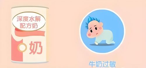 深度水解奶粉是什么意思？纽太特为何成为过敏宝宝替代饮食的首选