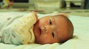 狗狗得了湿疹怎么办（治疗湿疹的方法和注意事项）