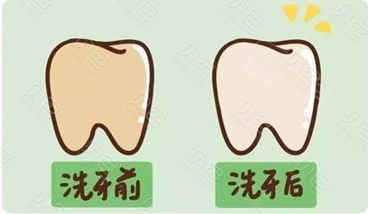 佳木斯富锦市京典口腔牙齿美白示意图