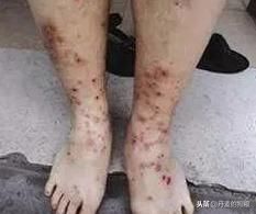 猫狗身上有跳蚤咋办？洗干净也还是无法杜绝？知道这些你就别愁了