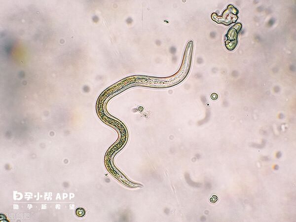 弓形虫是细胞内寄生虫