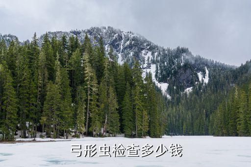 弓形虫检查多少钱