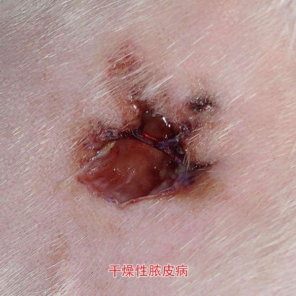 干燥性脓皮病.jpg