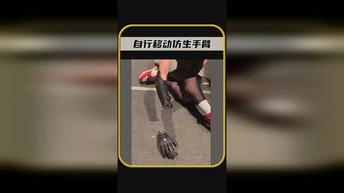 你知道吗，这就是可以自行移动的仿生手臂，真是太有趣了