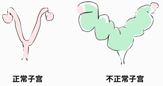 狗狗子宫蓄脓症状